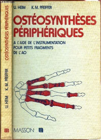 OSTEOSYNTHESES PERIPHERIQUES - A L'AIDE DE L'INSTRUMENTALISATION POUR PETITS FRAGMENTS …