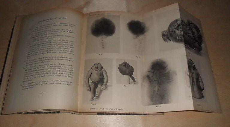 Annali di FRENIATRIA e scienze affini. vol XIII