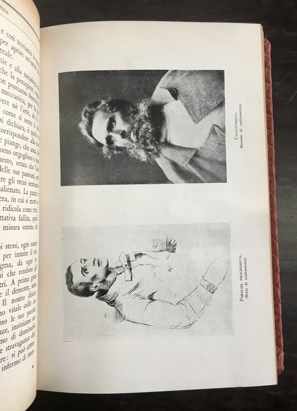 Storia della pazzia.