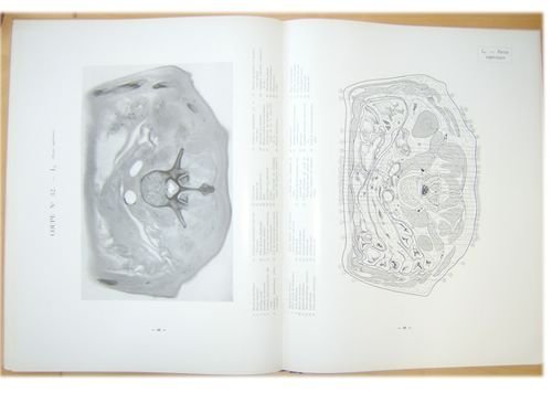 Coupes horizontales du tronc. Atlas anatomique et radiologique à l'usage …