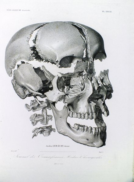 Atlas du Journal des Connaissances médico-chirurgicales