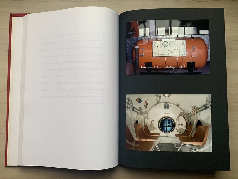 Sulla cosiddetta tossicità dell'ossigeno: terapia iperbarica a livello polmonare. Tesi … | Immagine Gallery 4