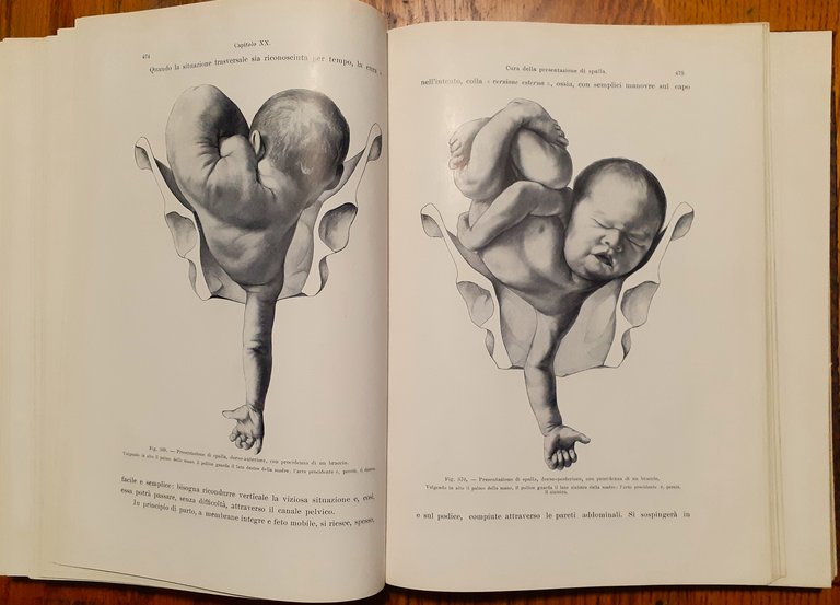 Trattato completo di ostetricia ad uso degli studenti e dei …