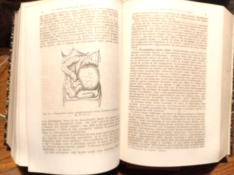 Trattato di Anatomia Patologica Generale e speciale