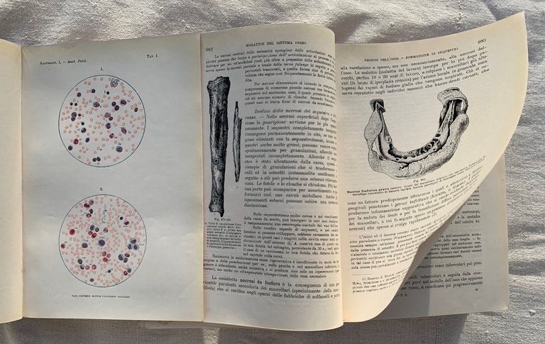 Trattato di Anatomia Patologica Speciale. Parte Prima (Apparato circolatorio - …