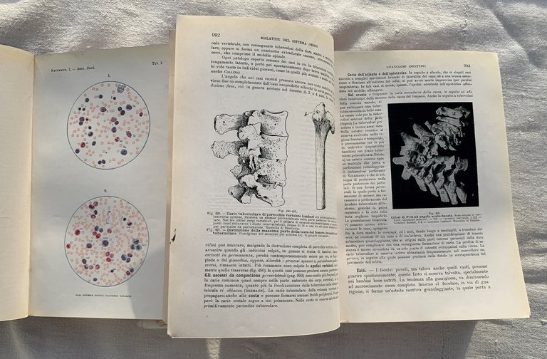 Trattato di Anatomia Patologica Speciale. Parte Prima (Apparato circolatorio - …