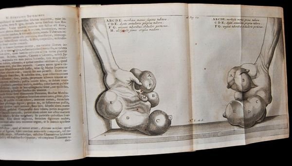 Marci Aurelii Severini De abscessuum recondita natura libri VIII. I. …