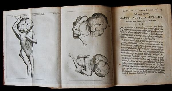 Marci Aurelii Severini De abscessuum recondita natura libri VIII. I. …