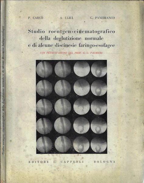 Studio roentgen-cinematografico della deglutizione normale e di alcune discinesie faringo-esofagee