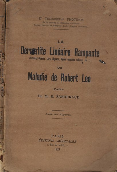 La Dermatite Linéaire Rampante ou Maladie de Robert Lee | Immagine principale