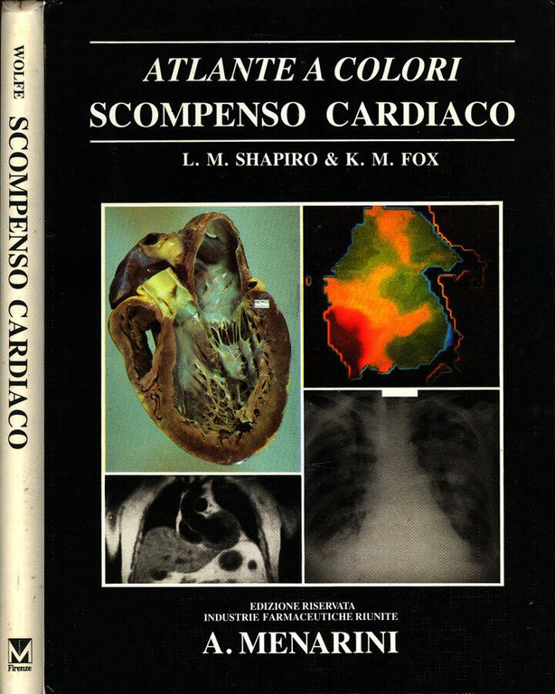 Atlante a colori scompenso cardiaco
