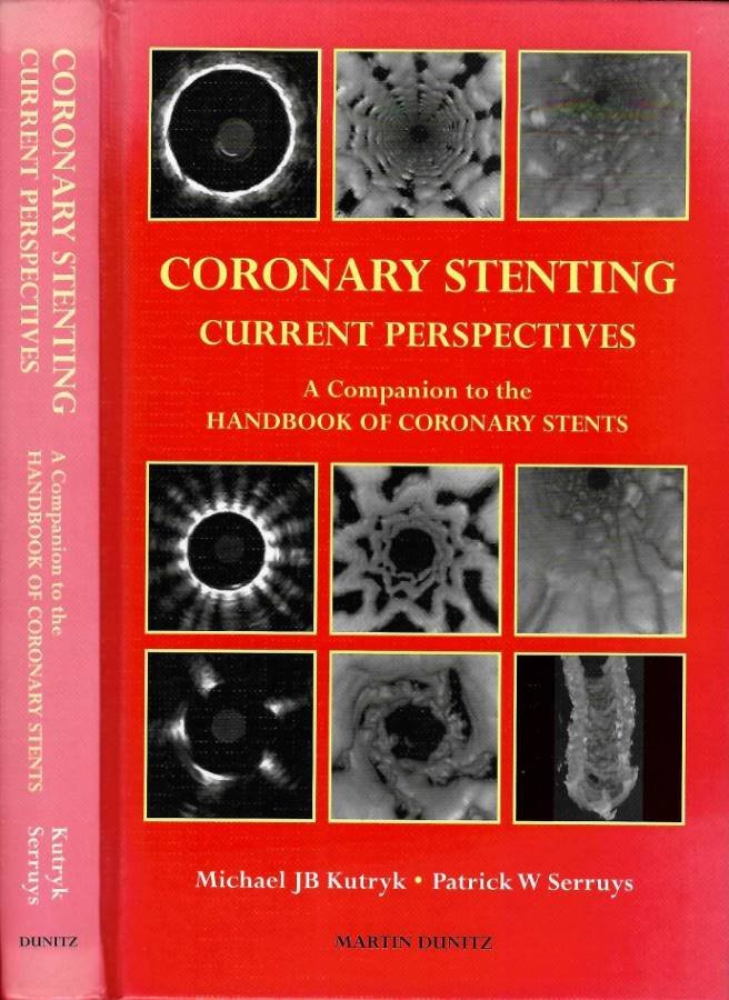 Coronary stenting: current perspectives | Immagine principale