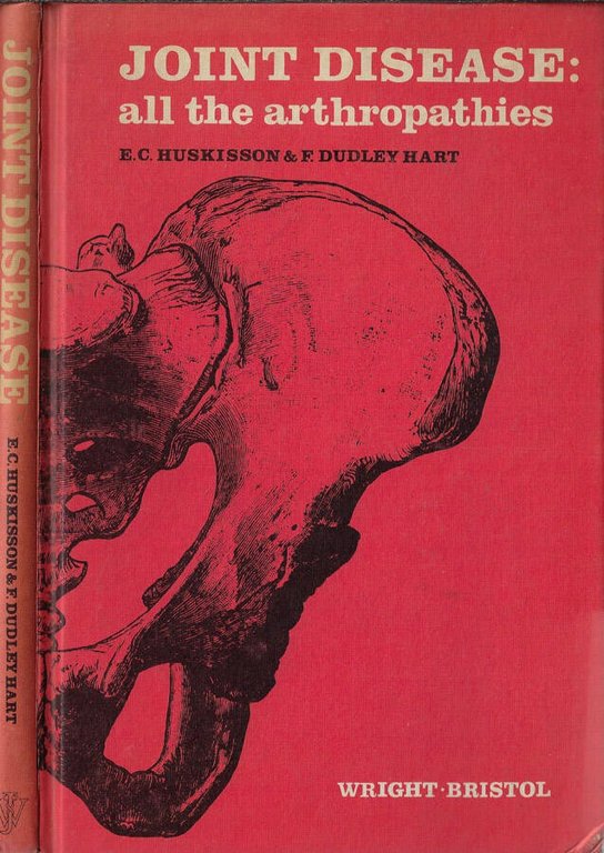 Joint disease: all the arthropathies | Immagine Gallery 2