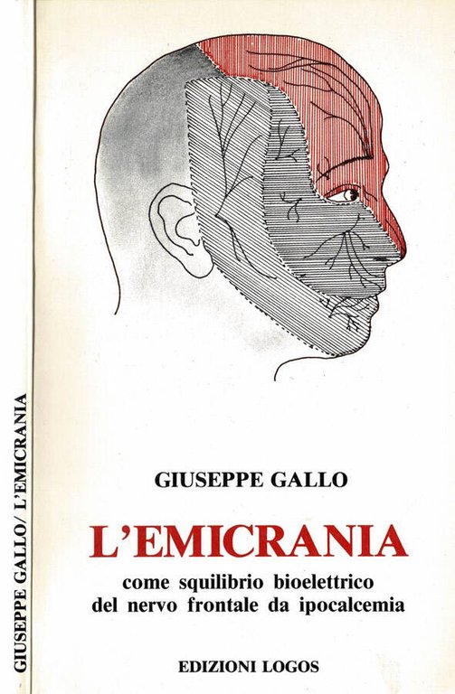 L'emicrania
