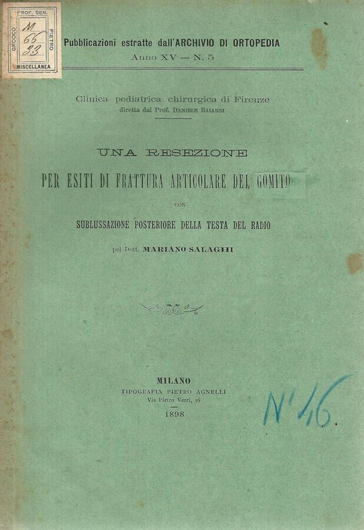 Una resezione per esiti di frattura articolare del gomito con …