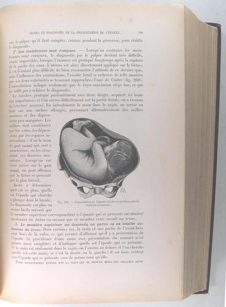Précis d'obstétrique.