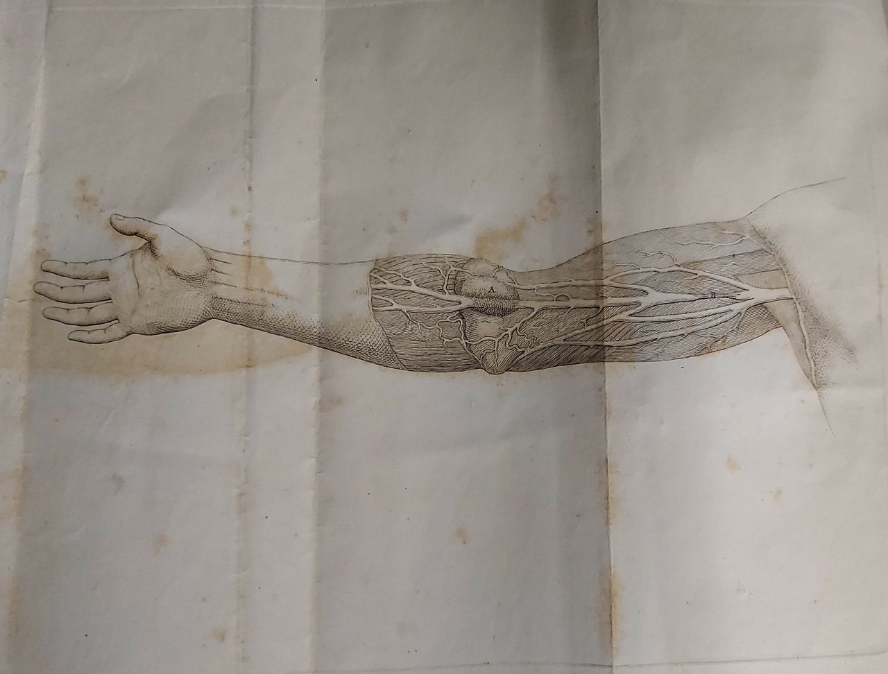 ESAME DEL BRACCIO D’UN UOMO stato operato per aneurisma col … | Immagine principale