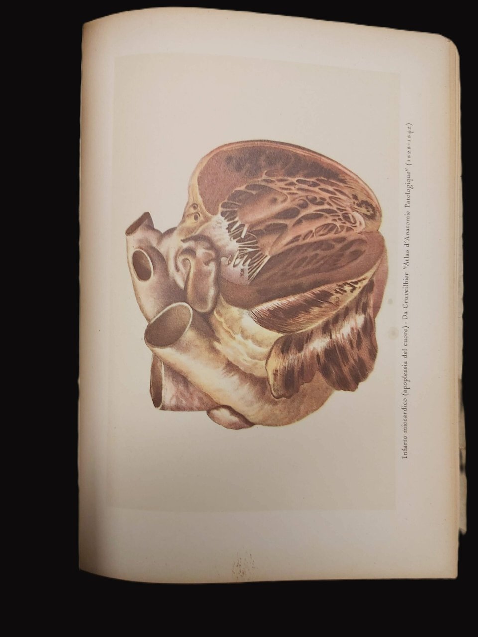 IL CUORE NELLA STORIA DELLA MEDICINA. | Immagine principale