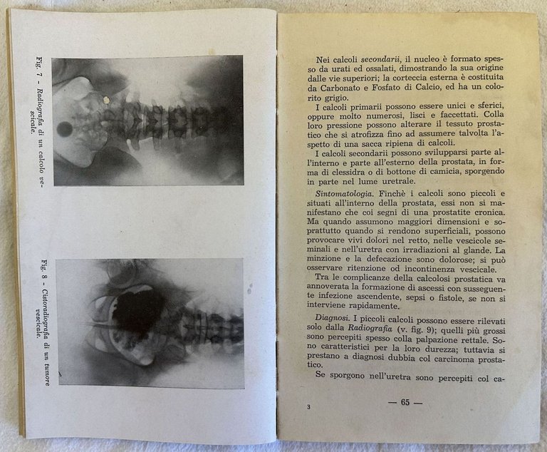 L'UROLOGIA PER IL MEDICO PRATICO VOLUME SECONDO | Immagine Gallery 2