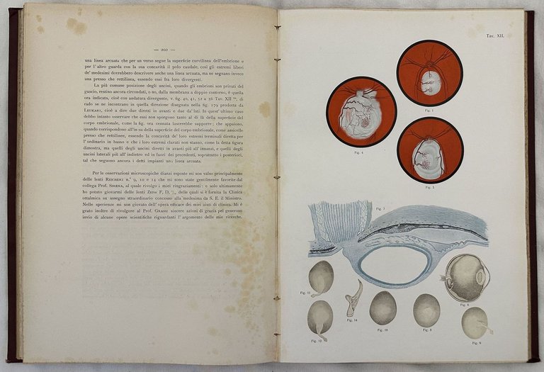 LAVORI IN OFTALMOLOGIA | Immagine Gallery 6
