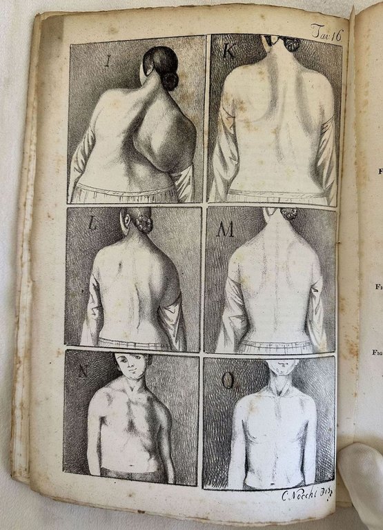 PROSPETTO DELL'IMPERIALE E REALE ISTITUTO ORTOPEDICO TOSCANO FONDATO E DIRETTO … | Immagine Gallery 6