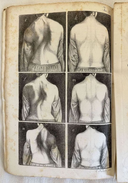 PROSPETTO DELL'IMPERIALE E REALE ISTITUTO ORTOPEDICO TOSCANO FONDATO E DIRETTO … | Immagine Gallery 5