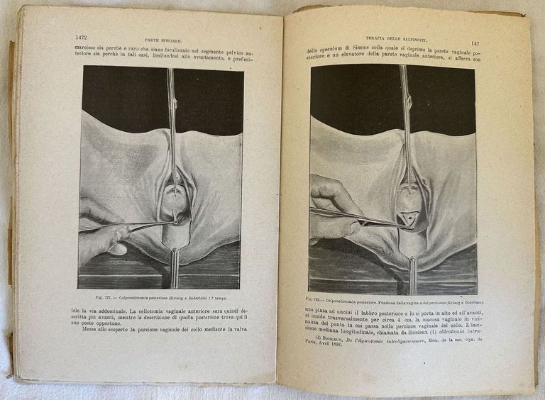 TRATTATO DI OSTETRICIA E GINECOLOGIA OSTETRICIA GINECOLOGIA
