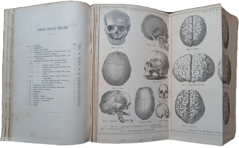 L'uomo di genio in rapporto alla psichiatria, alla storia ed …