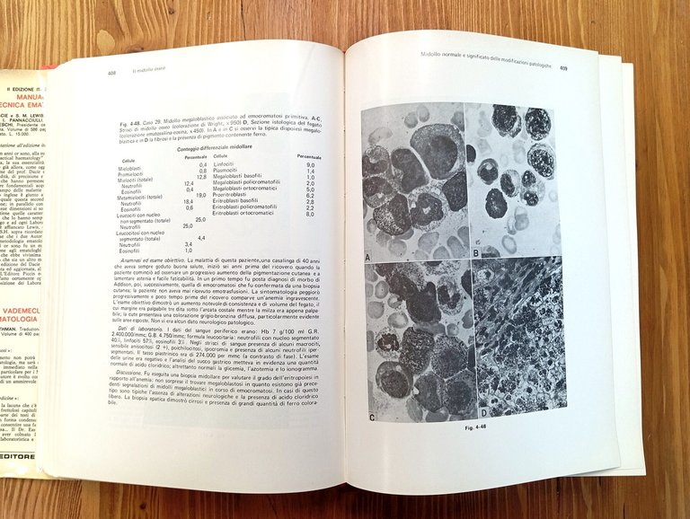Ematologia: diagnostica di laboratorio | Immagine Gallery 4