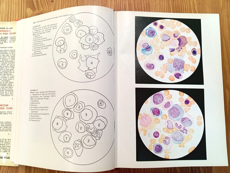 Ematologia: diagnostica di laboratorio | Immagine Gallery 5