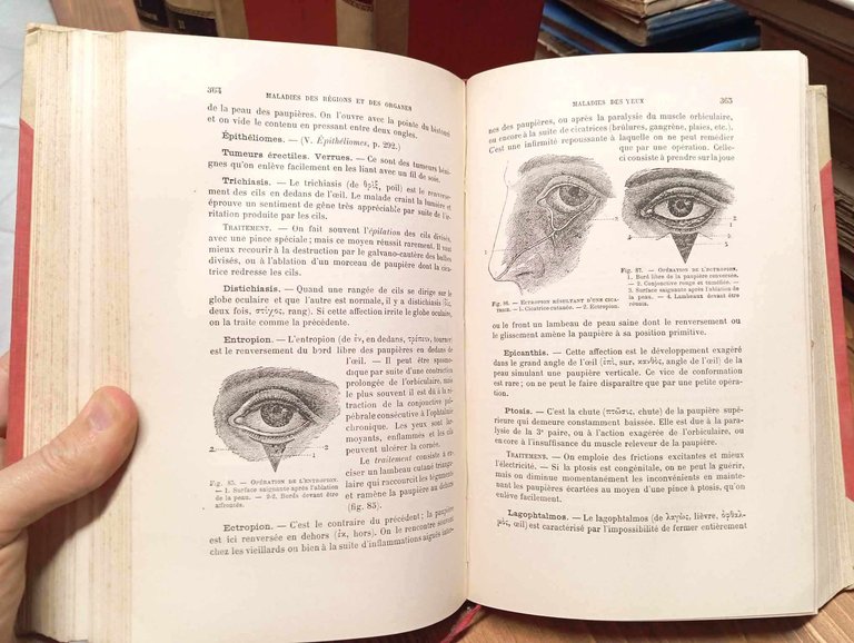 Traité complet de médecine pratique à l'usage des gens du …