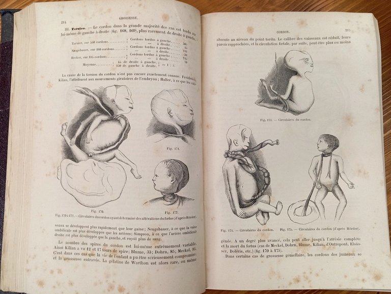Traité pratique des accouchements - Tome I et II