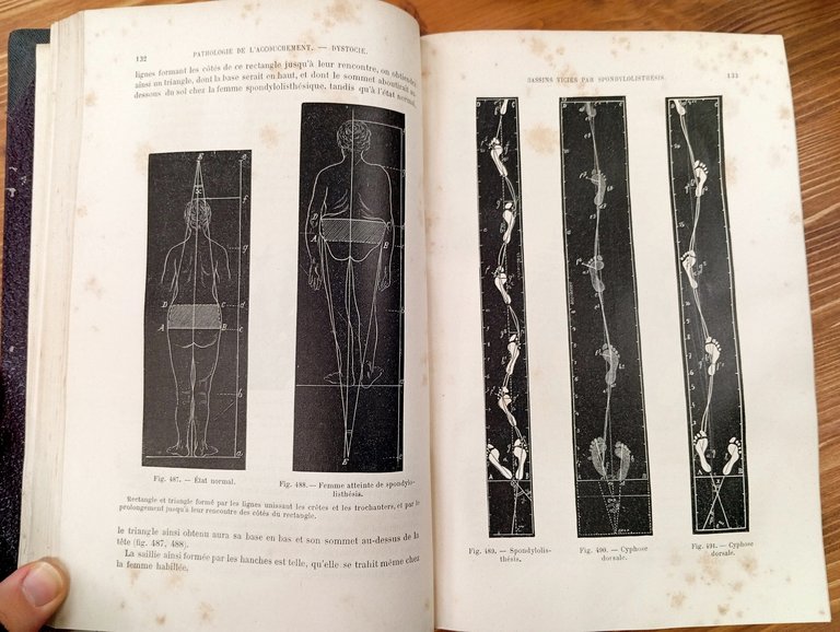 Traité pratique des accouchements - Tome I et II