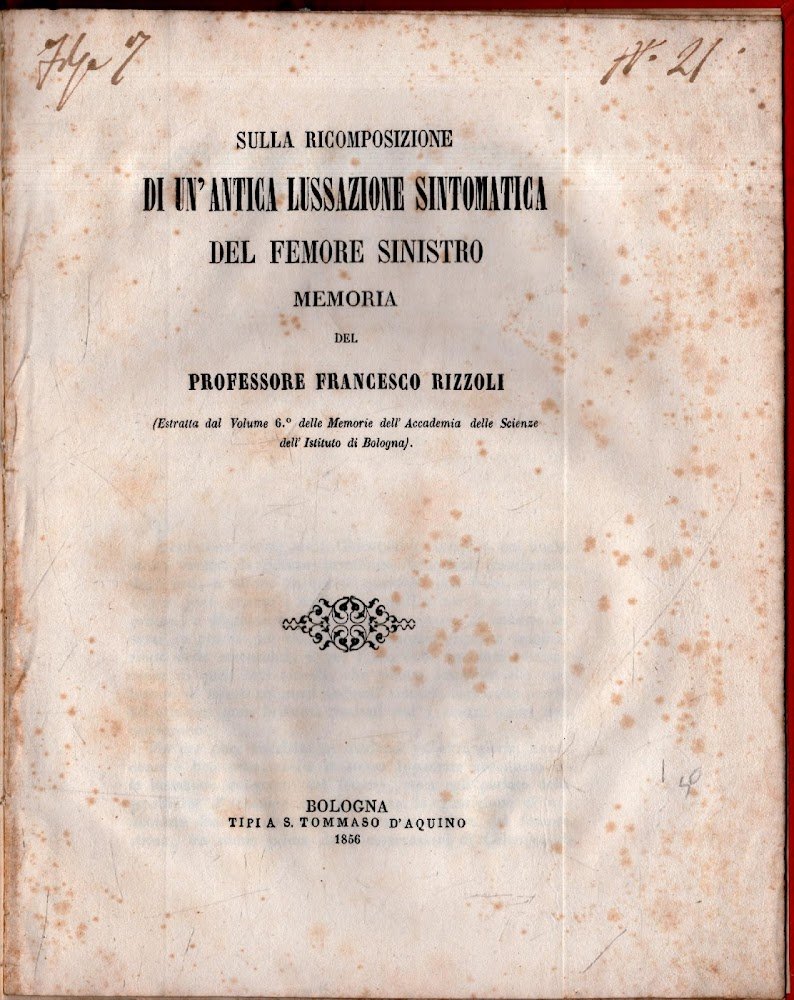 Sulla Ricomposizione di un'antica lussazione sintomatica del femore sinistro. Memoria …