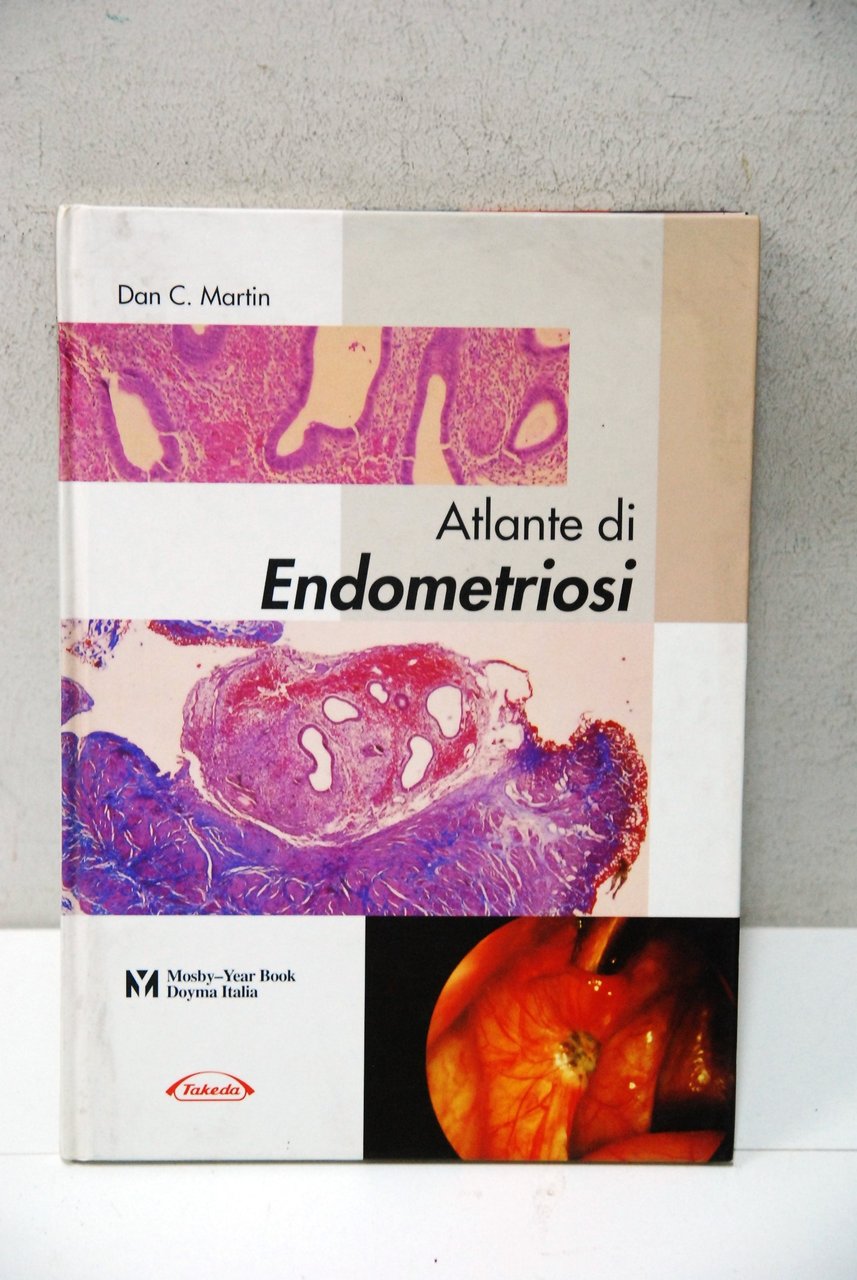 atlante di endometriosi NUOVO | Immagine principale