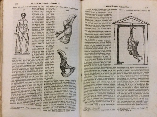TRATTATO DI PATOLOGIA ESTERNA E DI MEDICINA OPERATORIA. - Traduzione …