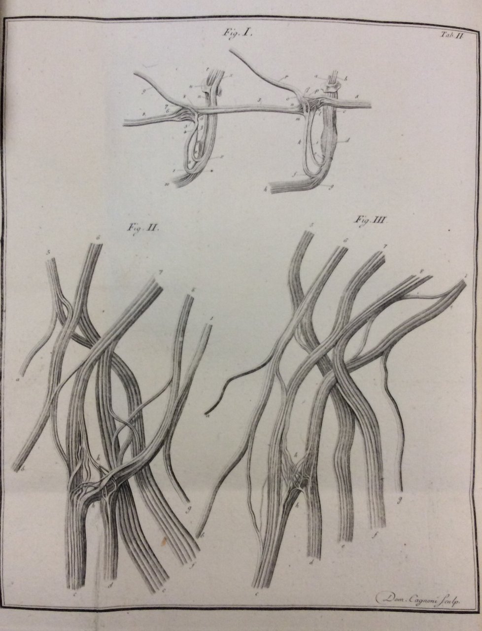 ANATOMICARUM ANNOTATIONUM. - Liber primus. De nervorum gangliis, et plexubus. …