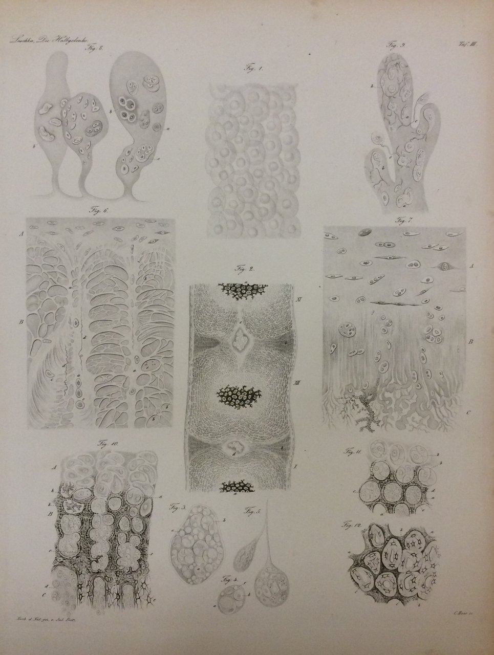 DIE HALBGELENKE DES MENSCHLICHEN KORPERS. - Eine Monographie mit sechs …