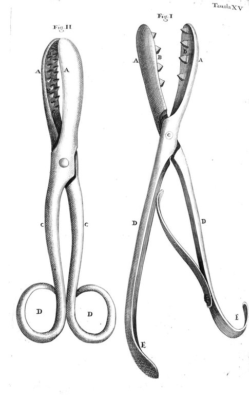 LITOTOMIA ovvero DEL CAVAR LA PIETRA.