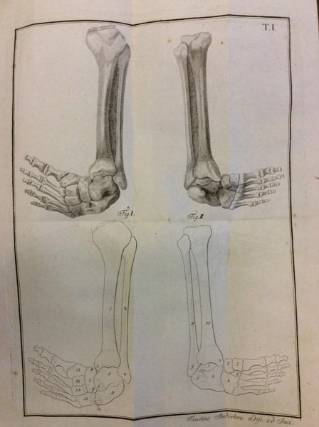 MEMORIA CHIRURGICA SUI PIEDI TORTI CONGENITI DEI FANCIULLI E SULLA … | Immagine Gallery 1