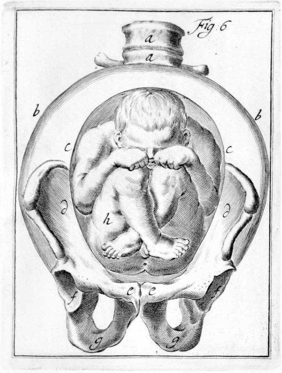 OPERATIONUM CHIRURGICARUM NOVUM LUMEN EXHIBENTIUM OBSTETRICANTIBUS. - Editio Secunda, cui …