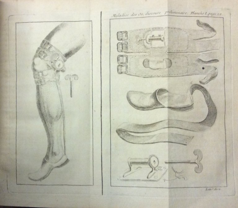 TRAITE' DES MALADIES DES OS. - Dans lequel on a …