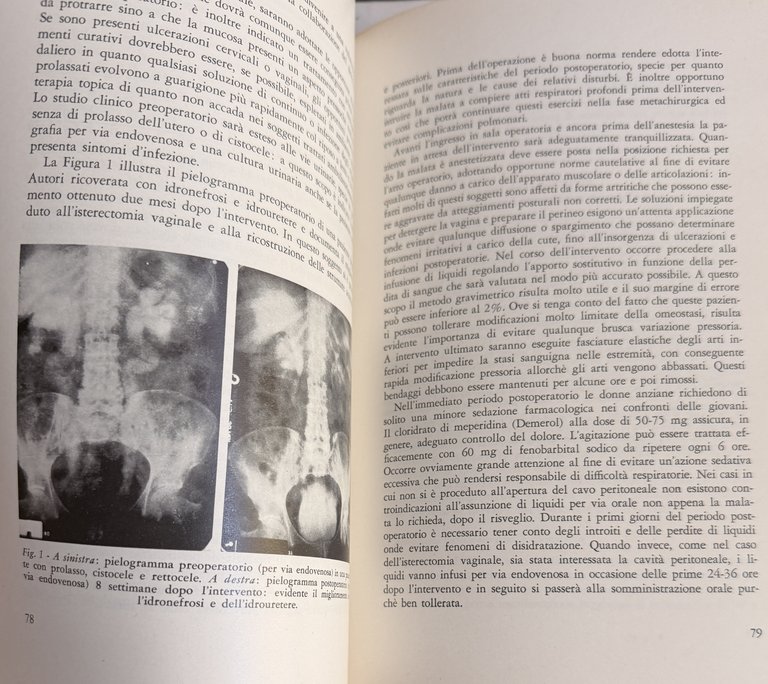 PROBLEMI MEDICI E CHIRURGICI IN MENOPAUSA | Immagine Gallery 12