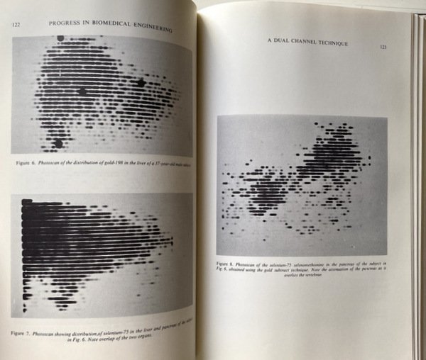 PROGRESS IN BIOMEDICAL ENGINEERING