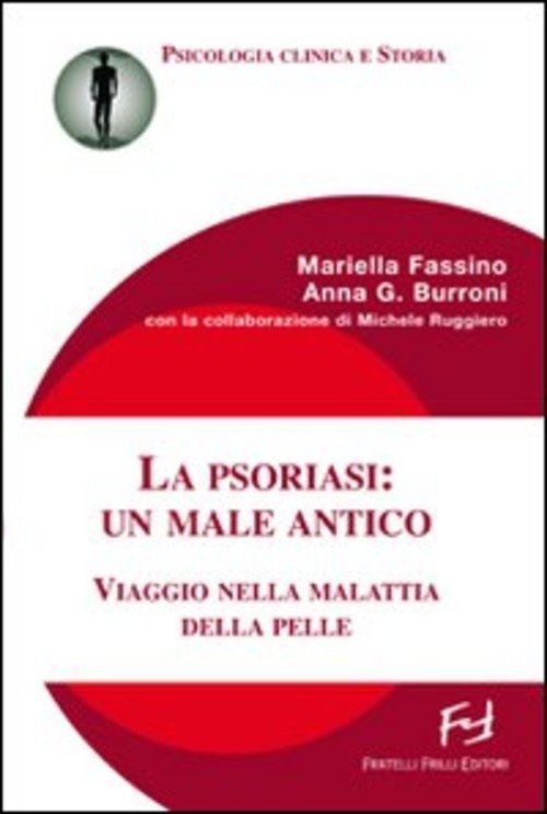 La Psoriasi: Un Male Antico. Viaggio Nella Malattia Della Pelle