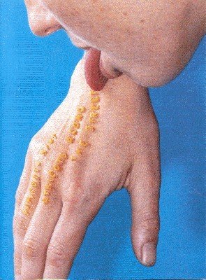 Apricots along the street.