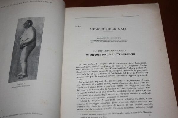 DI UN'INTERESSANTE MICROCEFALA LITTELIANA ARCHIVIO L'ANTROPOLOGIA ETNOLOGIA PAOLO MANTEGAZZA TIP.SALVADORE …