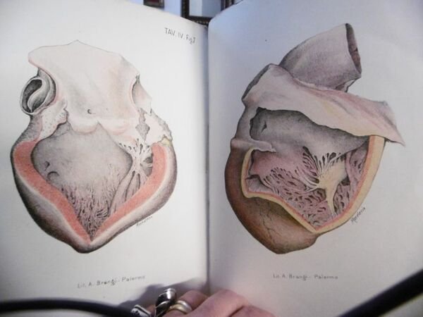 CUORE SFIGMICA E GLOBULIMETRIA DEGLI ALIENATI STUDI CLINICO SPERIMENTALI DOTT …