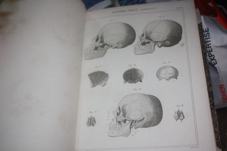 Antica incisione 1866 cranioscopia