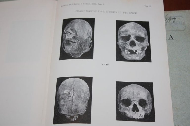 DATI CRANIOLOGICI SUI SANDE' ALDOBRANDINO MOCHIARCHIVIO PER L'ANTROPOLOGIA E LA …